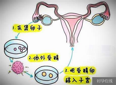 试管婴儿网站知乎