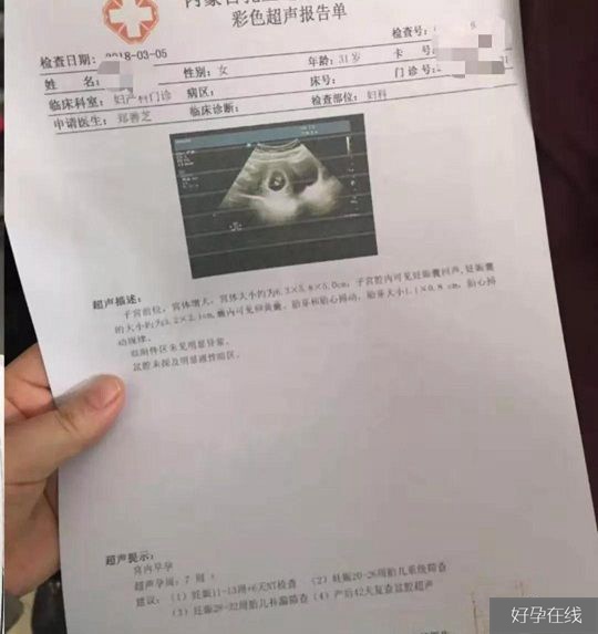 胎心报告