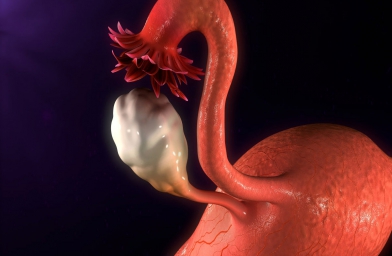 干细胞治疗卵巢早衰，患者顺利分娩健康宝宝